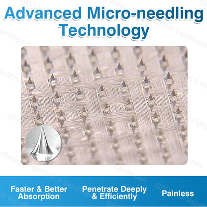 🇨🇦🏆✅️🏃ROVINAO® VeinRepair Microneedle Patch Roll⚡Instant Relief, Long-Term Results