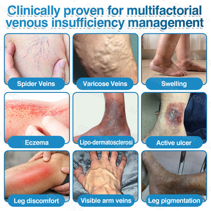 🇨🇦🏆✅️🏃ROVINAO® VeinRepair Microneedle Patch Roll⚡Instant Relief, Long-Term Results