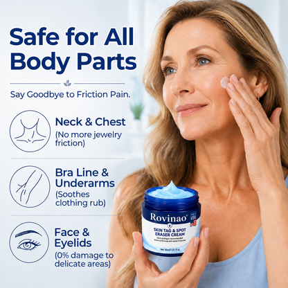 Rovinao® 7-Day Skin Tag & Spot Eraser Cream