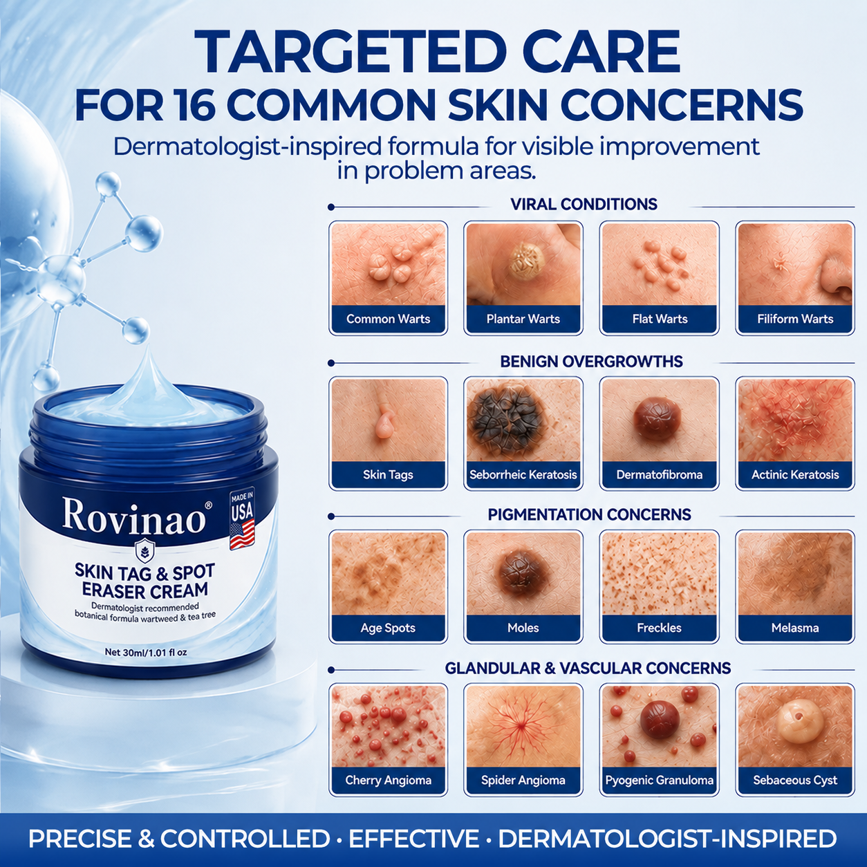 Rovinao® 7-Day Skin Tag & Spot Eraser Cream