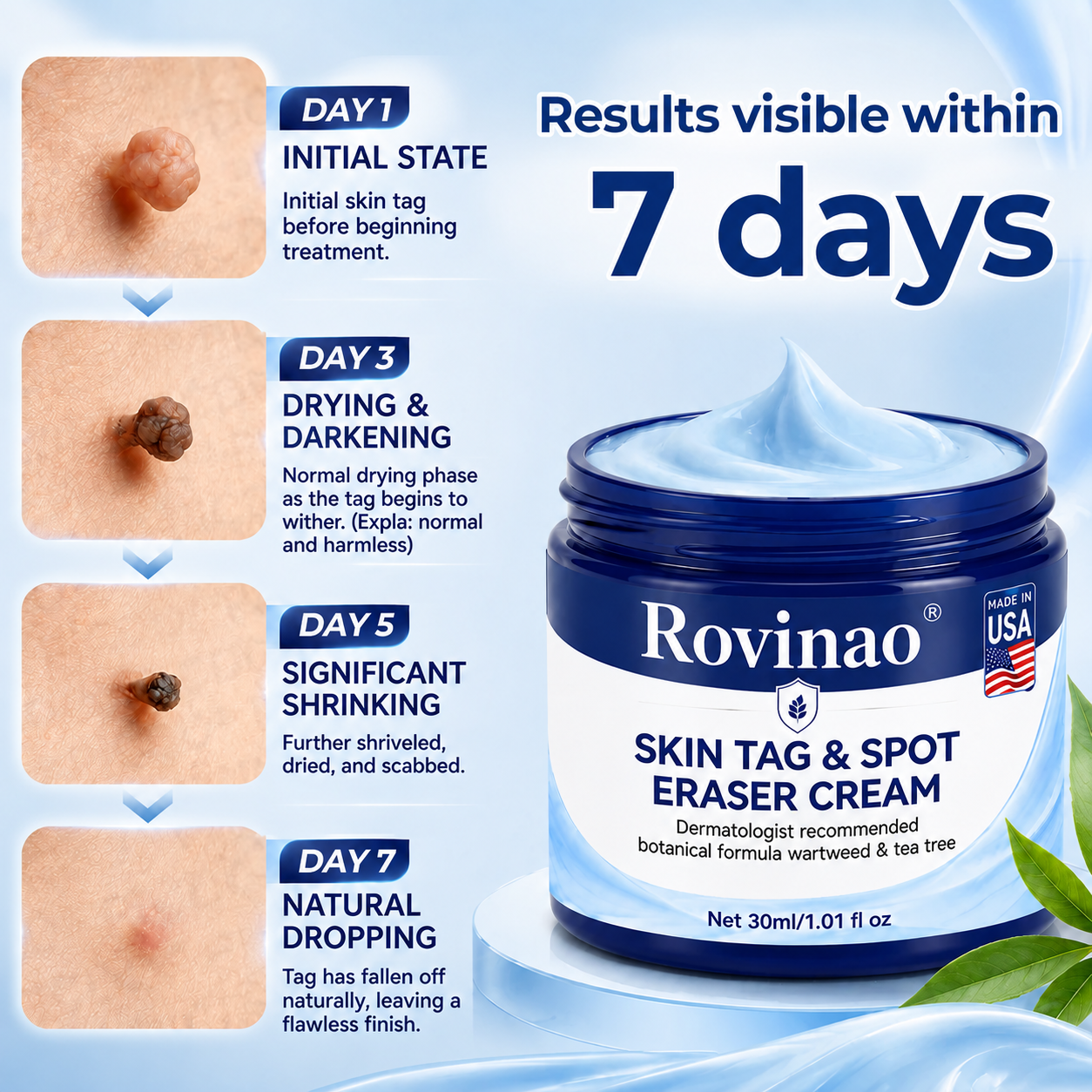 Rovinao® 7-Day Skin Tag & Spot Eraser Cream