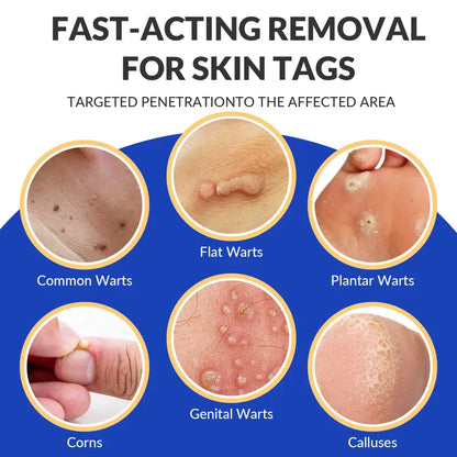 Dr.Ramay WART REMOVER GEL