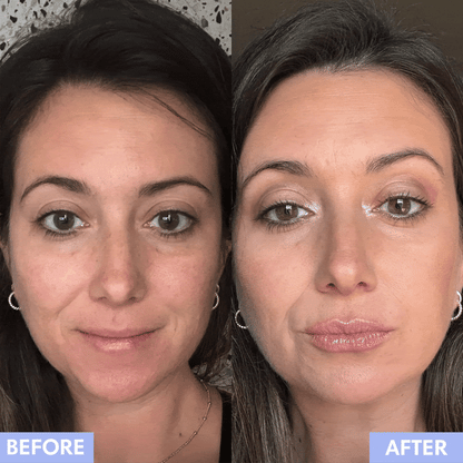 Lip Plumping Roller & Serum Kit